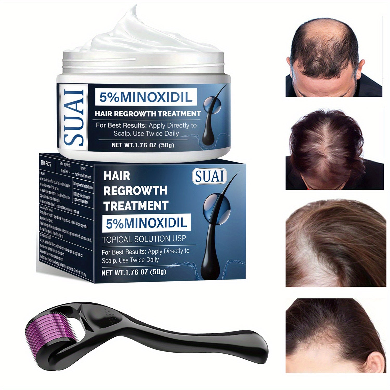 SUAI Hair Regrowth Treatment Kit with 5% Minoxidil, Hair Growth Cream and Dermaroller - Reverses Thinning, Strengthens Follicles for Thicker, Fuller Hair - Normal Hair Type, Promotes Natural Regrowth - ScalpX