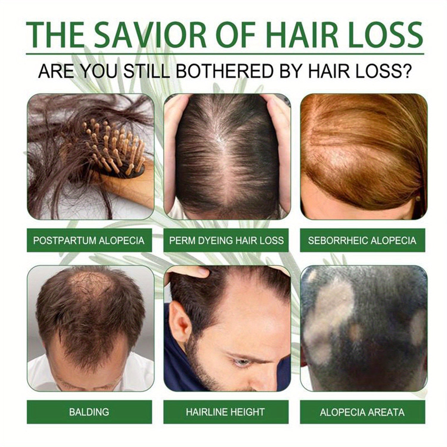 SUAI Hair Regrowth Treatment Kit with 5% Minoxidil, Hair Growth Cream and Dermaroller - Reverses Thinning, Strengthens Follicles for Thicker, Fuller Hair - Normal Hair Type, Promotes Natural Regrowth - ScalpX