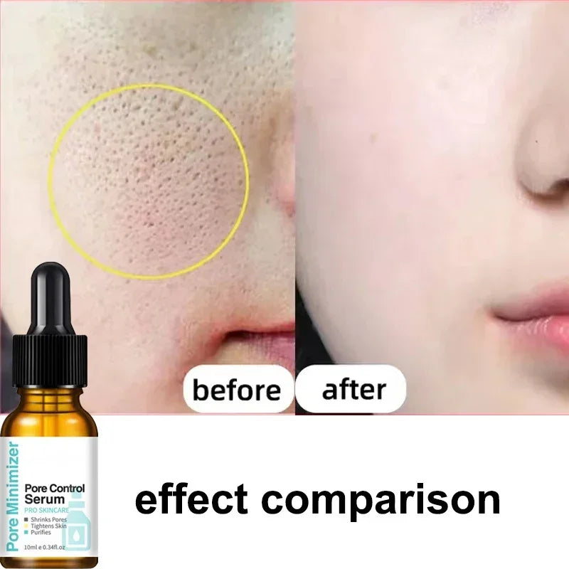 Pore Shrinking Serum Removing Big Pore Repairing Minimizing Facial Pores Oil Control Smoothing Tightening Skin Care Beauty - Scalpx