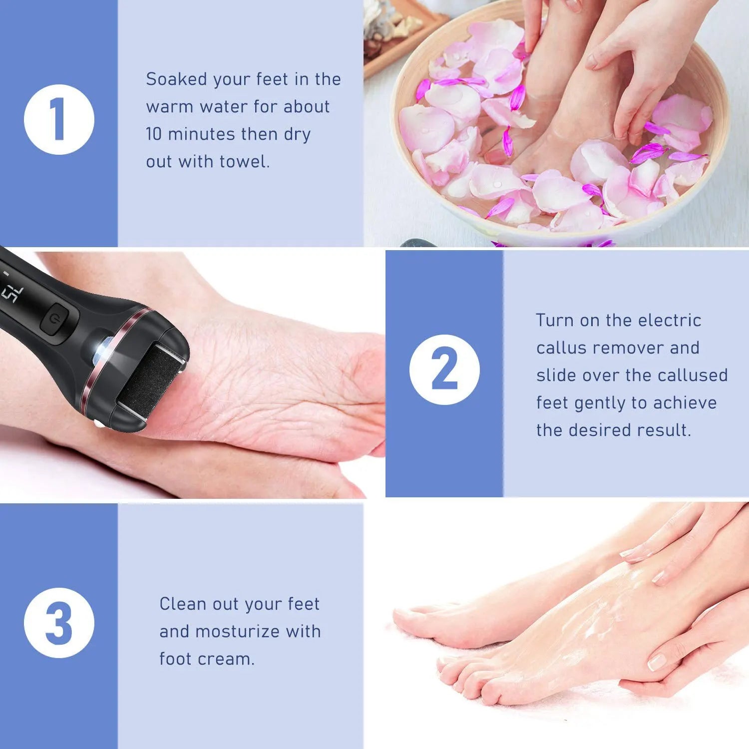 Electric Callus Remover - Scalpx