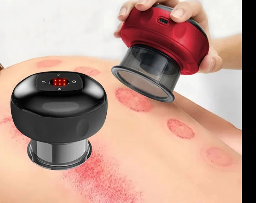 Electric Cupping Therapy Device - Scalpx