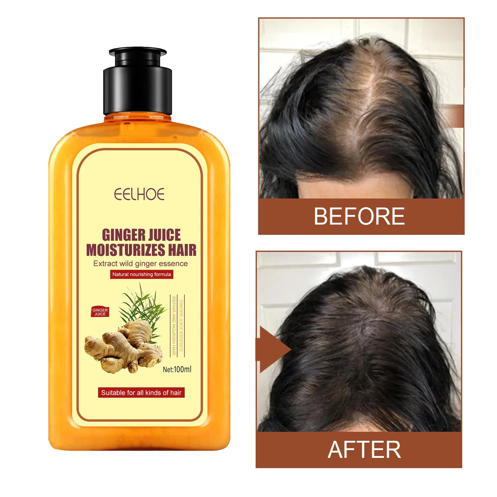 Ginger Juice Anti Hair-Loss Shampoo