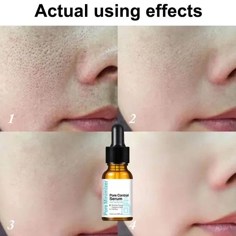 Pore Shrinking Serum Removing Big Pore Repairing Minimizing Facial Pores Oil Control Smoothing Tightening Skin Care Beauty - Scalpx