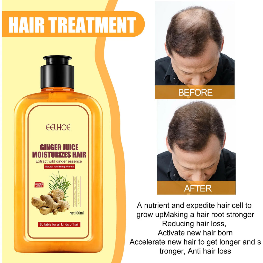 Ginger Hair Regrowth Shampoo Hair Loss Improve Dry Forked Hair Cleansing Dandruff Scalp growth Anti-Hair Loss Hair Shampoo - Scalpx