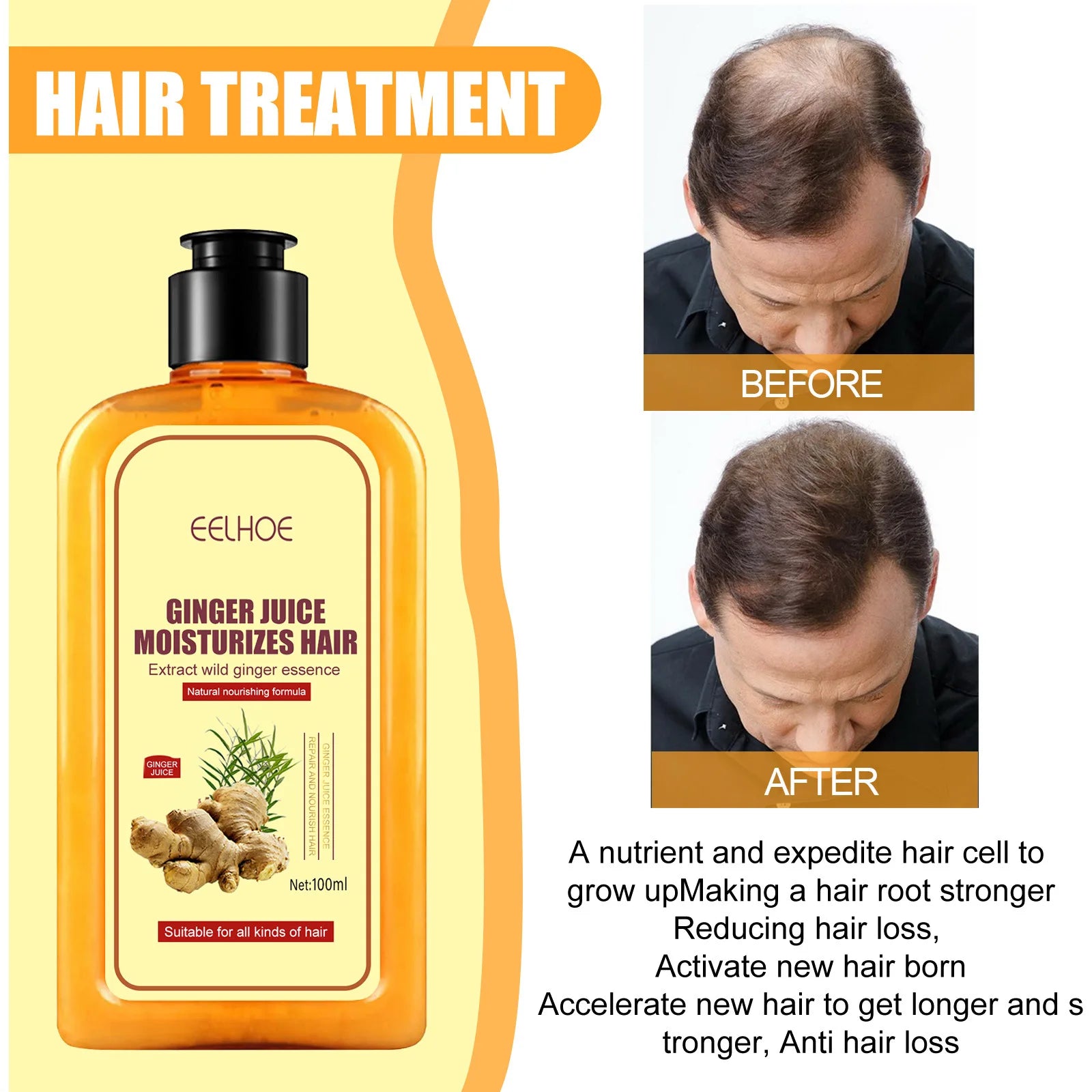 Ginger Hair Regrowth Shampoo Hair Loss Improve Dry Forked Hair Cleansing Dandruff Scalp growth Anti-Hair Loss Hair Shampoo - Scalpx