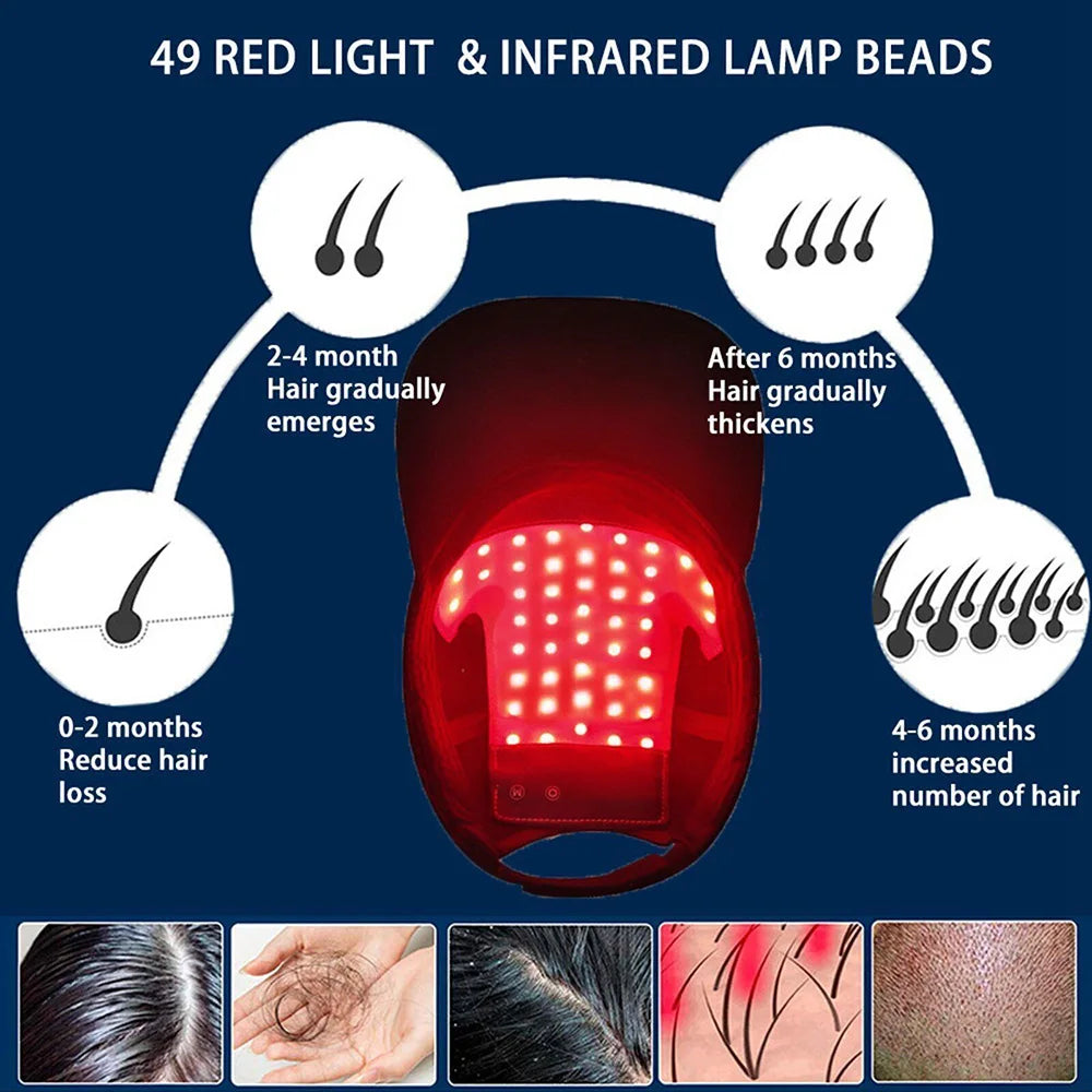 Infrared Red Light Therapy Cap Hair Regrowth Treatment Hat For Hair Regrowth Hair growth Anti-Hair Loss - Scalpx