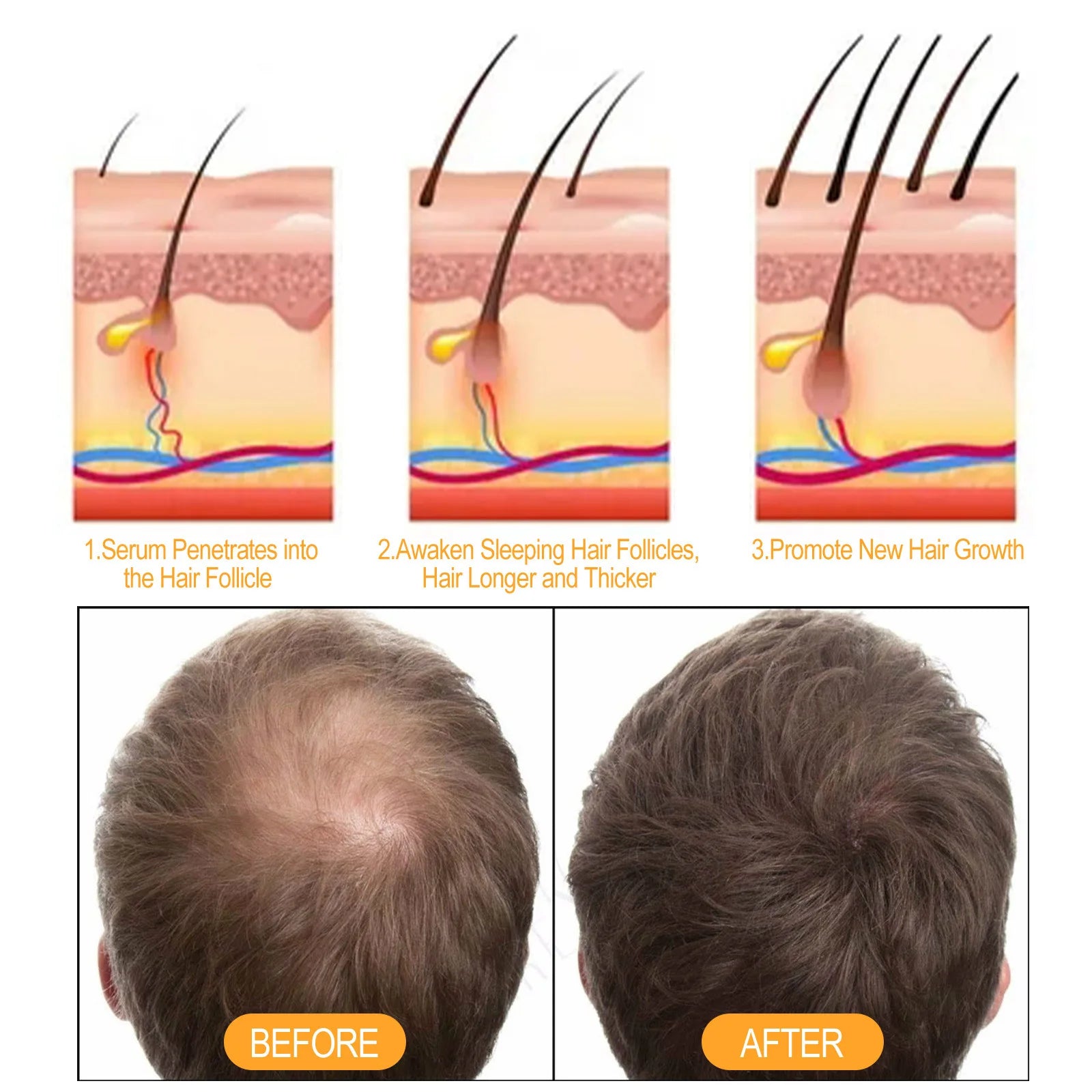 Ginger Hair Regrowth Shampoo Hair Loss Improve Dry Forked Hair Cleansing Dandruff Scalp growth Anti-Hair Loss Hair Shampoo - Scalpx