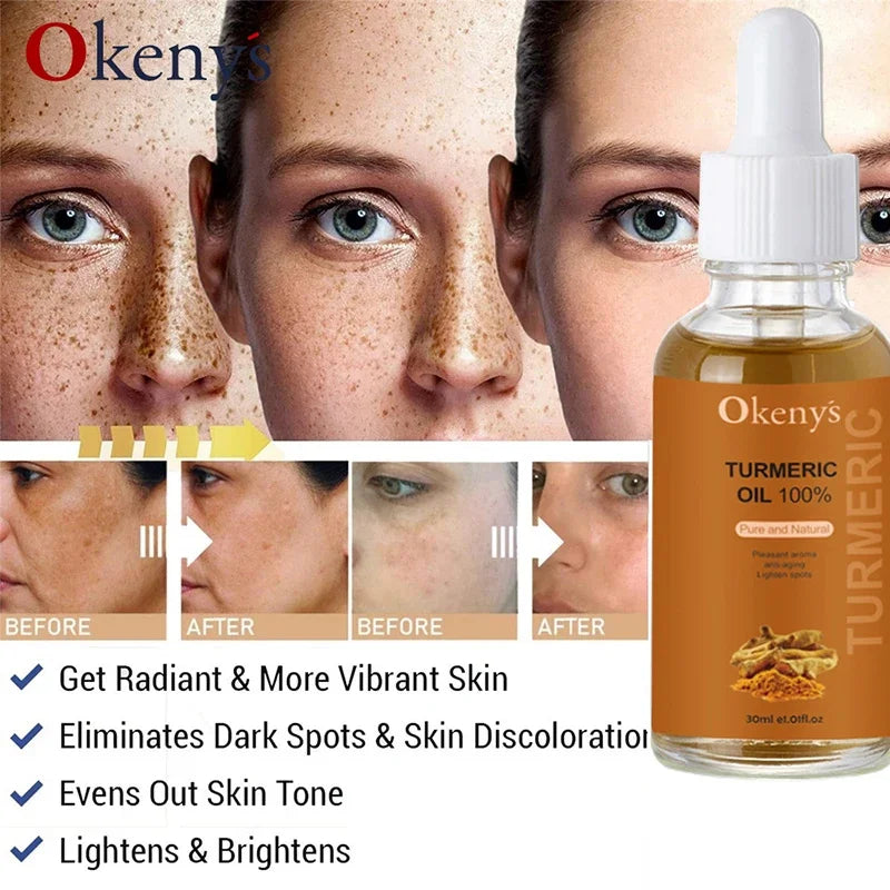 Turmeric Oil Discoloration Serum Pigment Corrector & Moisturizer Skin Care - Scalpx