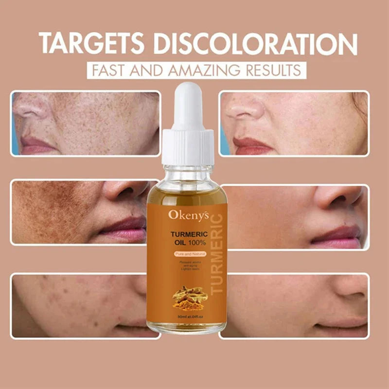 Turmeric Oil Discoloration Serum Pigment Corrector & Moisturizer Skin Care - Scalpx