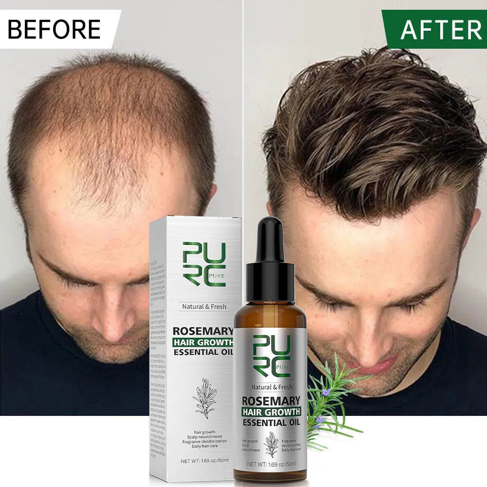 Rosemary Hair Growth Oil