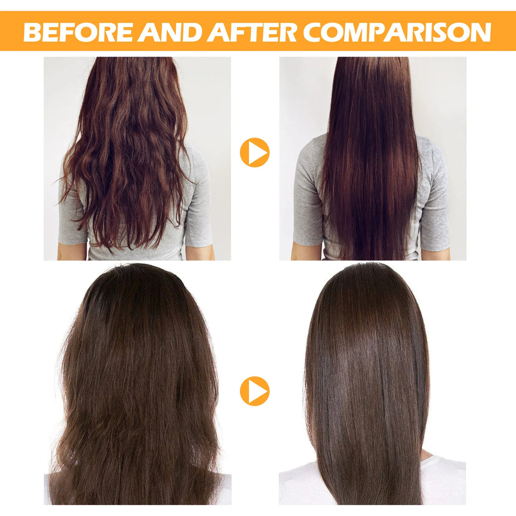 Ginger Hair Regrowth Shampoo Hair Loss Improve Dry Forked Hair Cleansing Dandruff Scalp growth Anti-Hair Loss Hair Shampoo - Scalpx