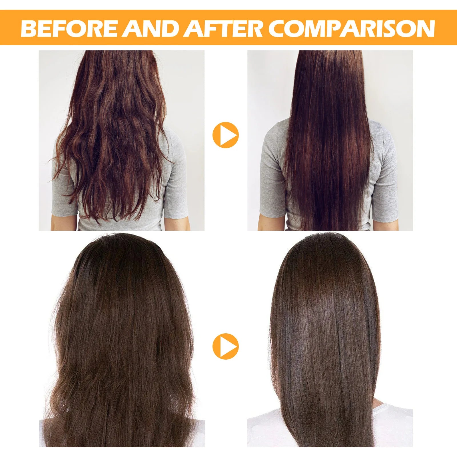 Ginger Hair Regrowth Shampoo Hair Loss Improve Dry Forked Hair Cleansing Dandruff Scalp growth Anti-Hair Loss Hair Shampoo - Scalpx