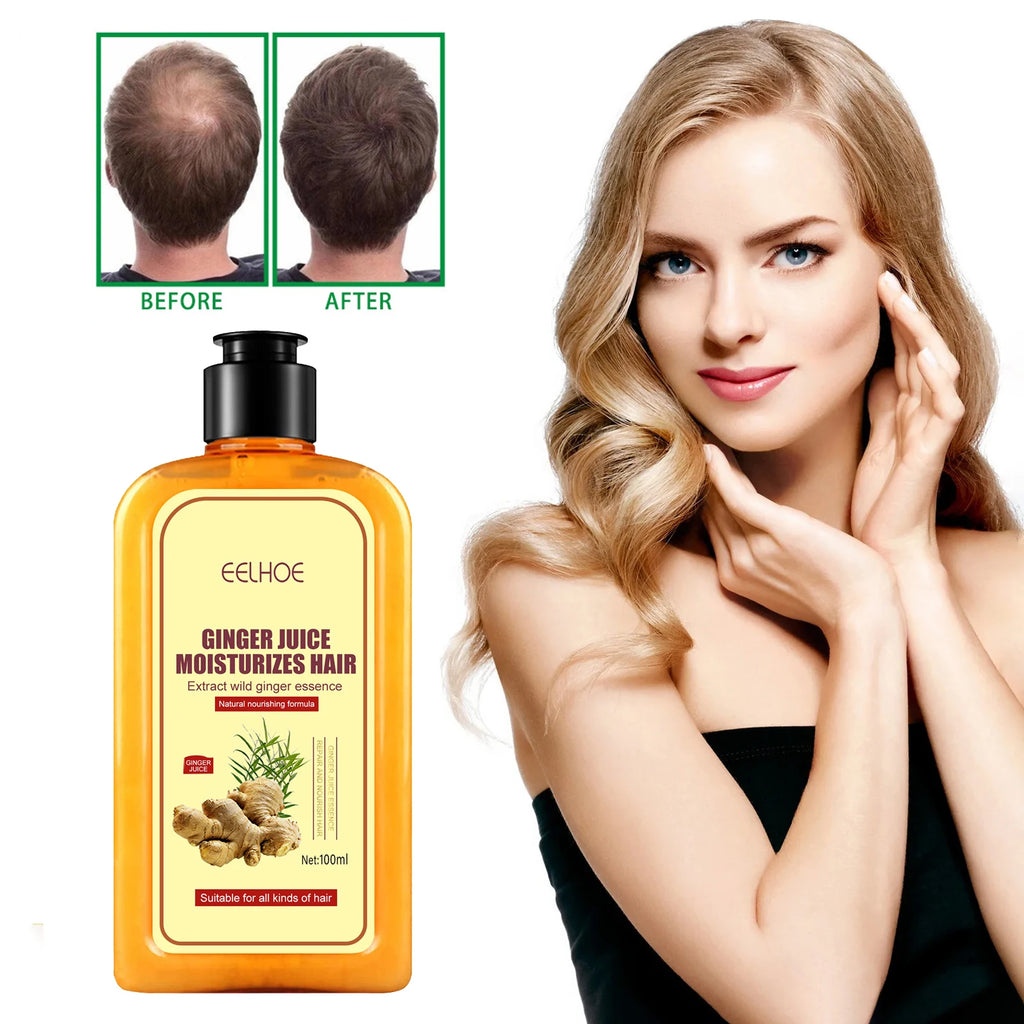 Ginger Hair Regrowth Shampoo Hair Loss Improve Dry Forked Hair Cleansing Dandruff Scalp growth Anti-Hair Loss Hair Shampoo - Scalpx
